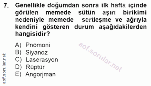 7. soru: Genellikle doğumdan sonra ilk hafta içinde görülen memede sütün aşırı birikimi nedeniyle memede sertleşme ve ağrıyla…