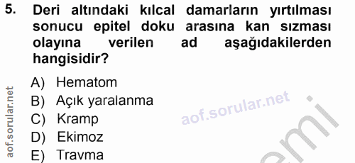 5. soru: Deri altındaki kılcal damarların yırtılması sonucu epitel doku arasına kan sızması olayına verilen ad aşağıdakilerden…