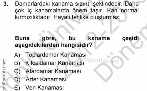 3. soru: Damarlardaki kanama sızıntı şeklindedir. Daha çok iç kanamalarda önem taşır. Kan normal kırmızılıktadır. Hayati tehli…
