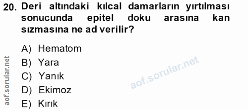 20. soru: Deri altındaki kılcal damarların yırtılması sonucunda epitel doku arasina m kan sızmasına ne ad verilir? A) Hematom B…
