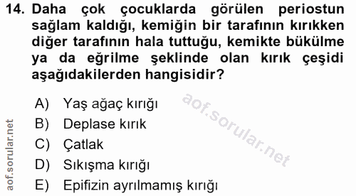 14. soru: Daha çok çocuklarda görülen periostun sağlam kaldığı, kemiğin bir tarafının kırıkken diğer tarafının hala tuttuğu, ke…