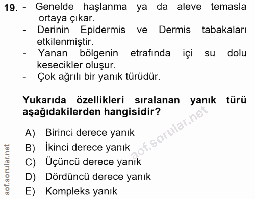 19. soru: - Genelde haşlanma ya da aleve temasla ortaya çıkar. - Derinin Epidermis ve Dermis tabakaları etkilenmiştir. - Yanan…