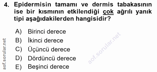 4. soru: Epidermisin tamamı ve dermis tabakasının ise bir kısmının etkilendiği çok ağrılı yanık tipi aşağıdakilerden hangisidi…