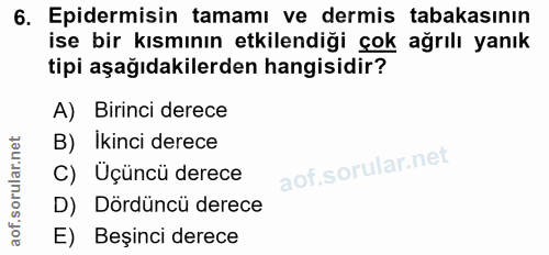 6. soru: Epidermisin tamamı ve dermis tabakasının ise bir kısmının etkilendiği çok ağrılı yanık tipi aşağıdakilerden hangisidi…