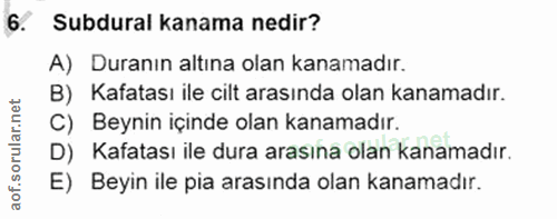 6. soru: Subdural kanama nedir? A) Duranın altına olan kanamadır. B) Kafatası ile cilt arasında olan kanamadır. C) Beynin için…