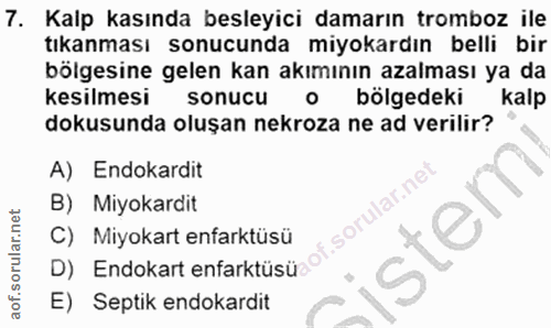 7. soru: Kalp kasında besleyici damarın tromboz ile tıkanması sonucunda miyokardın belli bir bölgesine gelen kan akımının azal…