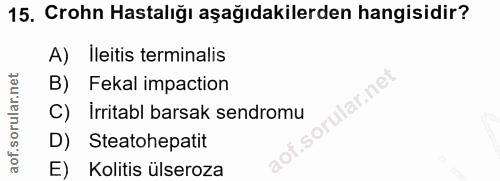 15. soru: Crohn Hastalığı aşağıdakilerden hangisidir? A) lleitis terminalis B) Fekal impaction lar.ne C) Irritabl barsak sendro…