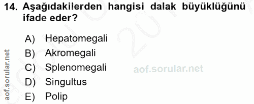 14. soru: Aşağıdakilerden hangisi dalak büyüklüğünü ifade eder? A) Hepatomegali B) Akromegali C) Splenomegali D) Singultus E) P…
