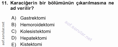 11. soru: Karaciğerin bir bölümünün çıkarılmasına ne ad verilir? A) Gastrektomi B) Hemoroidektomi C) Kolesistektomi D) Hepatekt…