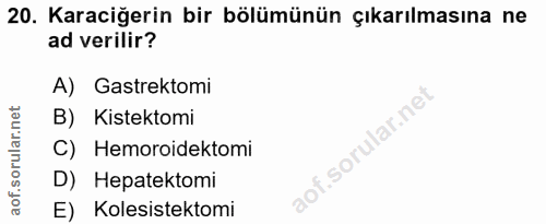 20. soru: Karaciğerin bir bölümünün çıkarılmasına ne ad verilir? A) Gastrektomi B) Kistektomi C) Hemoroidektomi D) Hepatektomi…
