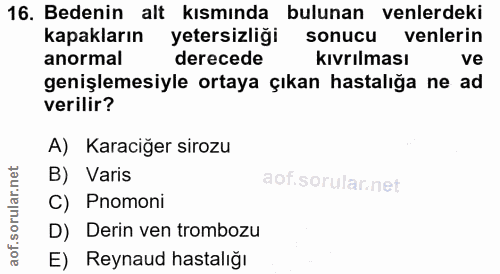 16. soru: Bedenin alt kısmında bulunan enlerdeki kapakların yetersizliği sonucu venlerin anormal derecede kıvrılması ve genişle…