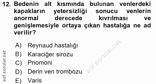 12. soru: Bedenin alt kısmında bulunan venlerdeki kapakların yetersizliği sonucu venlerin anormal derecede kıvrılması ve genişl…