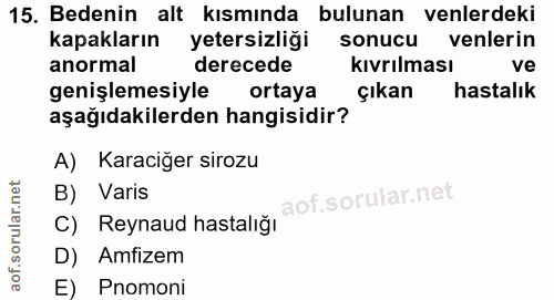 15. soru: Bedenin alt kısmında bulunan enlerdeki kapakların yetersizliği sonucu venlerin anormal derecede kivrilması ve genişle…