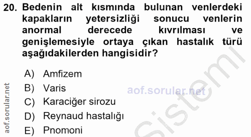 20. soru: Bedenin alt kısmında bulunan venlerdeki kapakların yetersizliği sonucu venlerin anormal derecede kıvrılması ve genişl…