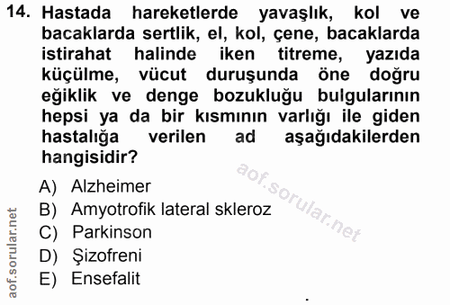 14. soru: Hastada hareketlerde yavaşlık, kol ve bacaklarda sertlik, el, kol, çene, bacaklarda istirahat halinde iken titreme, y…