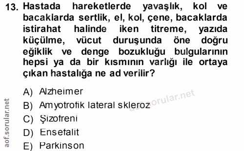 13. soru: Hastada hareketlerde yavaşlık, kol ve bacaklarda sertlik, el, kol, çene, bacaklarda istirahat halinde iken titreme, y…
