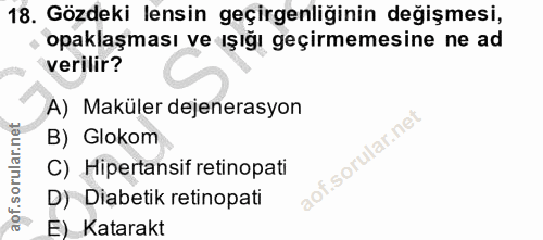 18. soru: Gözdeki lensin geçirgenliğinin değişmesi, opaklaşması ve ışığı geçirmemesine ne ad verilir? A) Maküler dejenerasyon B…