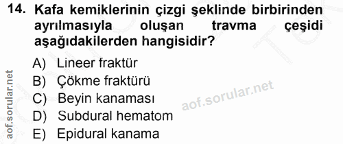 14. soru: Kafa kemiklerinin çizgi şeklinde birbirinden ayrılmasıyla oluşan travma çeşidi aşağıdakilerden hangisidir? A) Lineer…