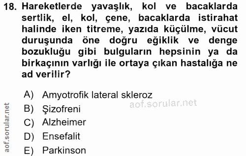 18. soru: Hareketlerde yavaşlık, kol ve bacaklarda sertlik, el, kol, çene, bacaklarda istirahat halinde iken titreme, yazıda kü…