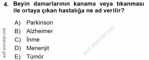 4. soru: Beyin damarlarının kanama veya tıkanması ile ortaya çıkan hastalığa ne ad verilir? A) Parkinson B) Alzheimer C) Inme…