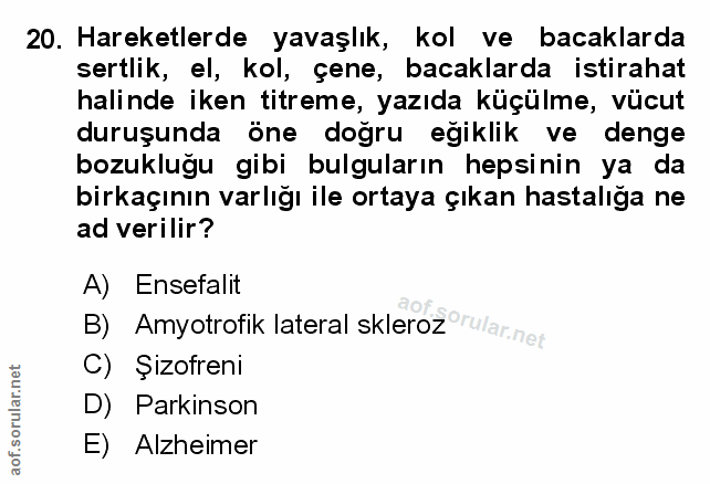 20. soru: Hareketlerde yavaşlık, kol ve bacaklarda sertlik, el, kol, çene, bacaklarda istirahat halinde iken titreme, yazıda kü…