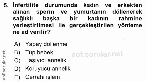 5. soru: Infertilite durumunda kadın ve erkekten alınan sperm ve yumurtanın döllenerek sağlıklı başka bir kadının rahmine yerl…