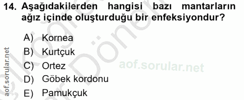 14. soru: Aşağıdakilerden hangisi bazı mantarların ağız içinde oluşturduğu bir enfeksiyondur? A) Kornea B) Kurtçuk C) Ortez D)…