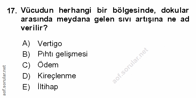 17. soru: Vücudun herhangi bir bölgesinde, dokular arasında meydana gelen sıvı artışına ne ad verilir? A) Vertigo B) Pihtı geli…