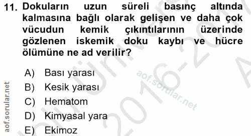11. soru: Dokuların uzun süreli basinç altinda kalmasına bağlı olarak gelişen ve daha çok vücudun kemik çıkıntılarının üzerinde…